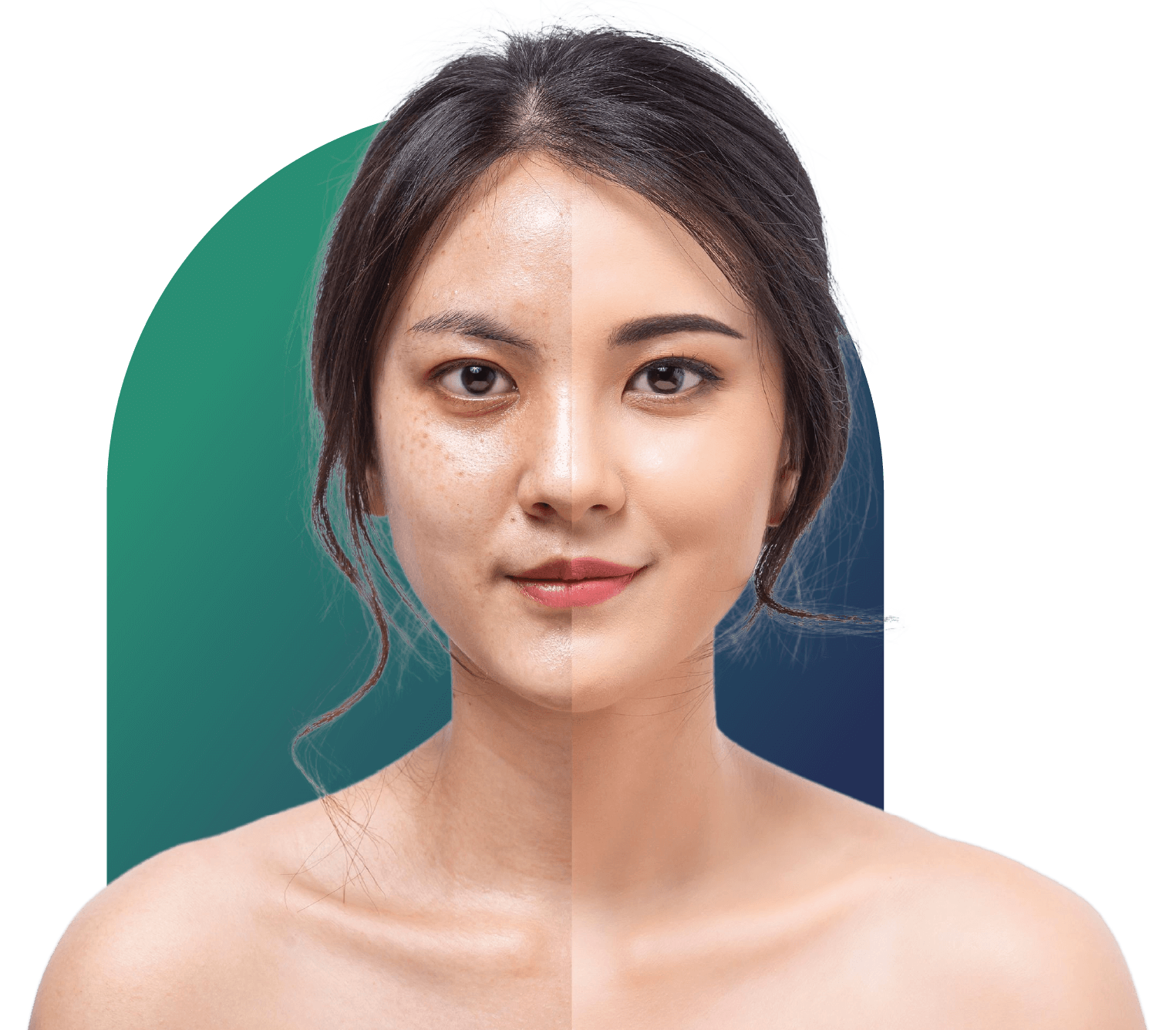 Skin whitening treatment for women